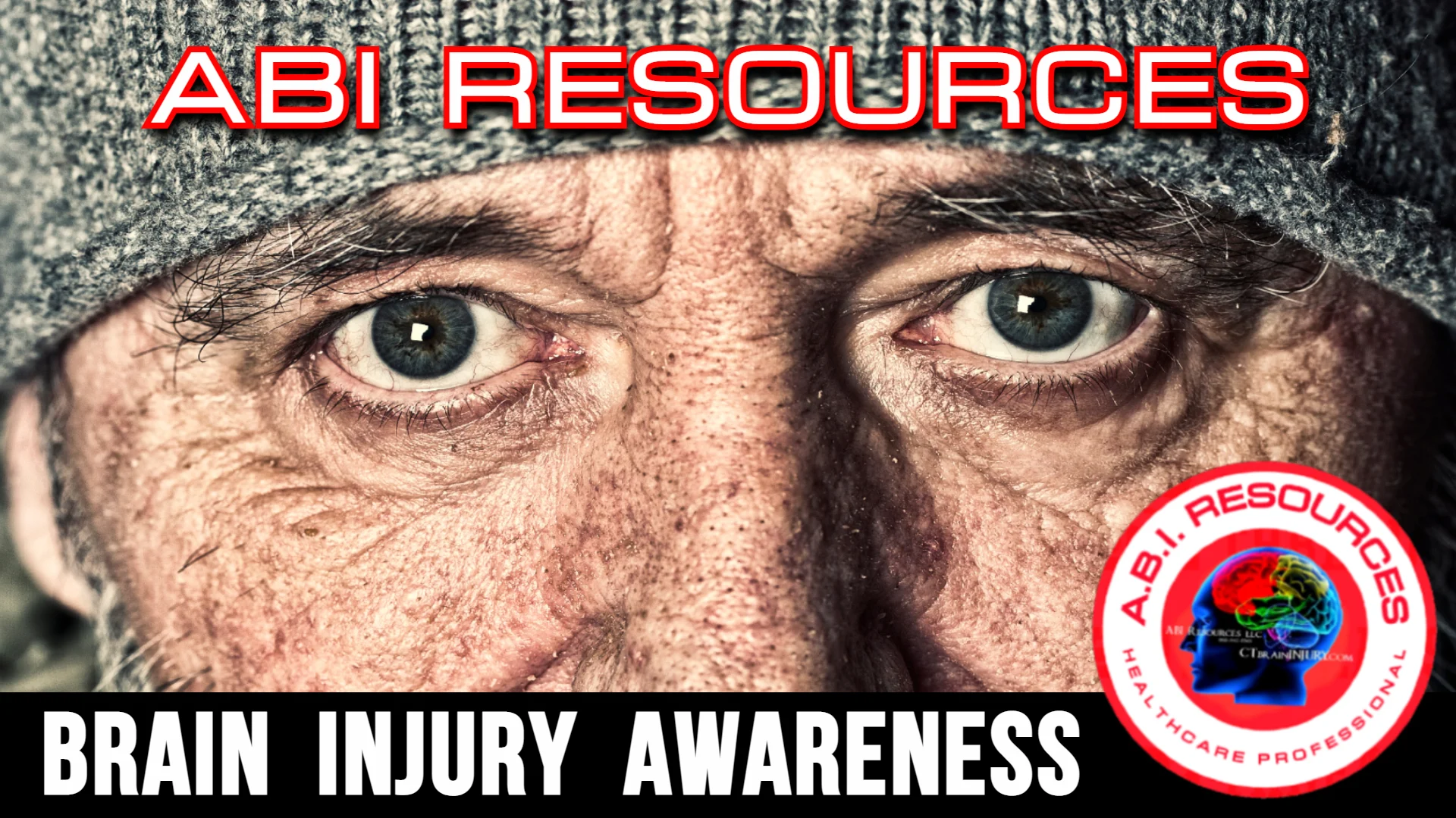 Archived ABI Resources Facebook image associated with BRAIN INJURY AWARENESS #tbi #tbiawareness #homeless #poverty #awareness Brain injuries can have a significant impact…
