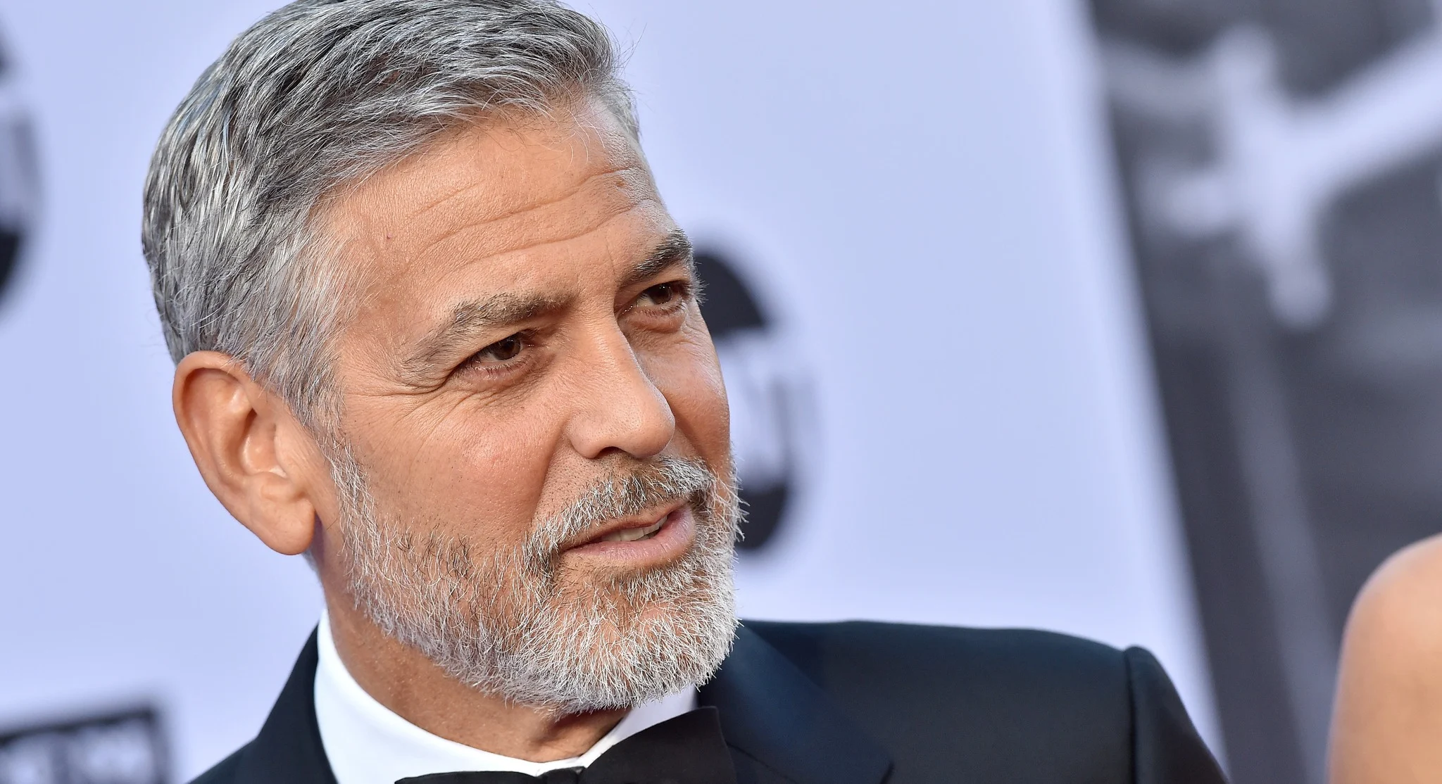 Archived ABI Resources Facebook image associated with So, what’s the connection between Oscar-winning actor George Clooney and Traumatic Brain Injury (TBI)? Clooney and hi…